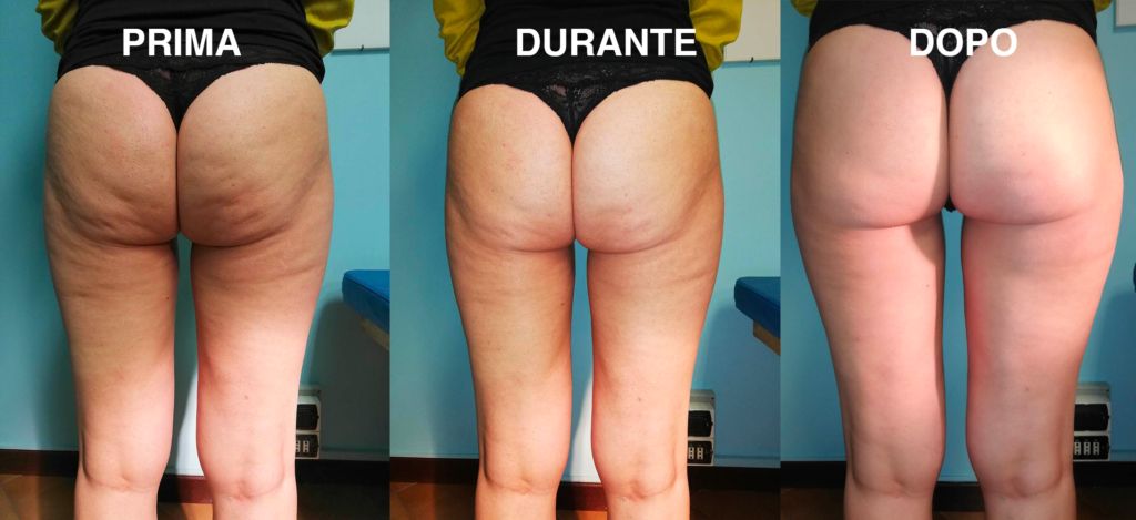 Edoardo Leonardo Rubattu-46