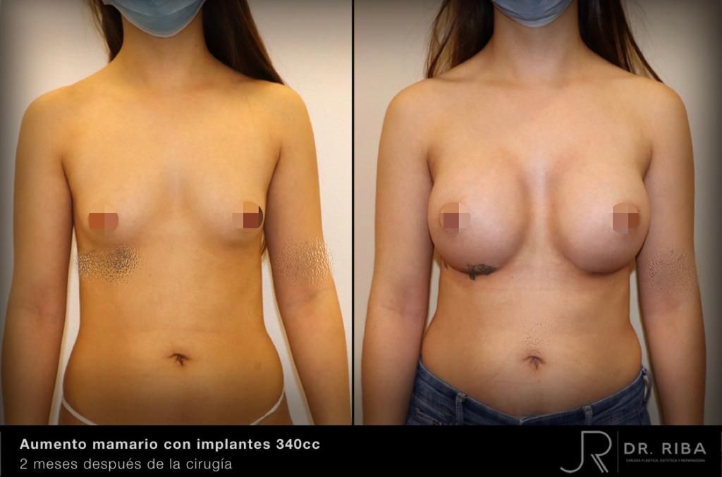 Jordi Riba Vilchez-8