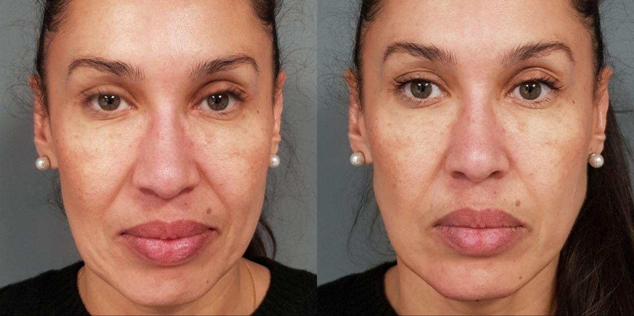 Rosalba Herrero Zerpa-69