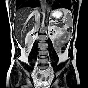 Risonanza Magnetica-1