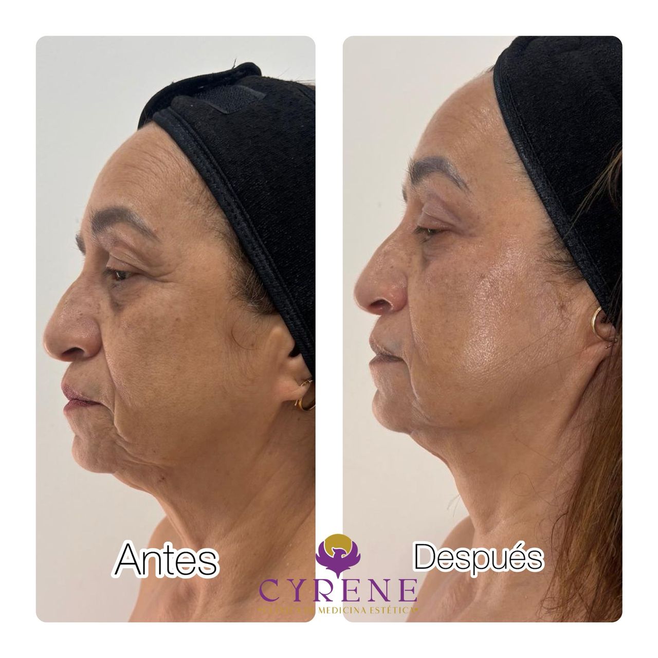 Yolimar Acevedo Raya-1