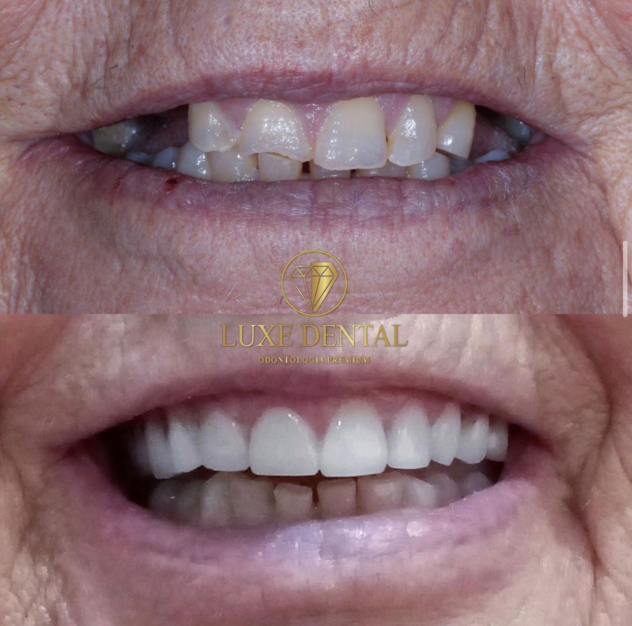 Ruben Patier Martin-9