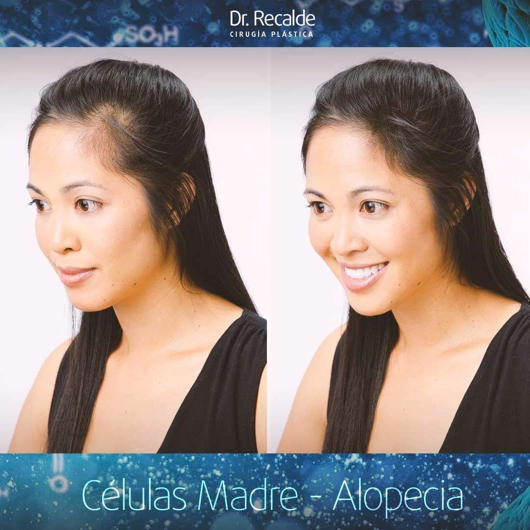 César Recalde Losada-14