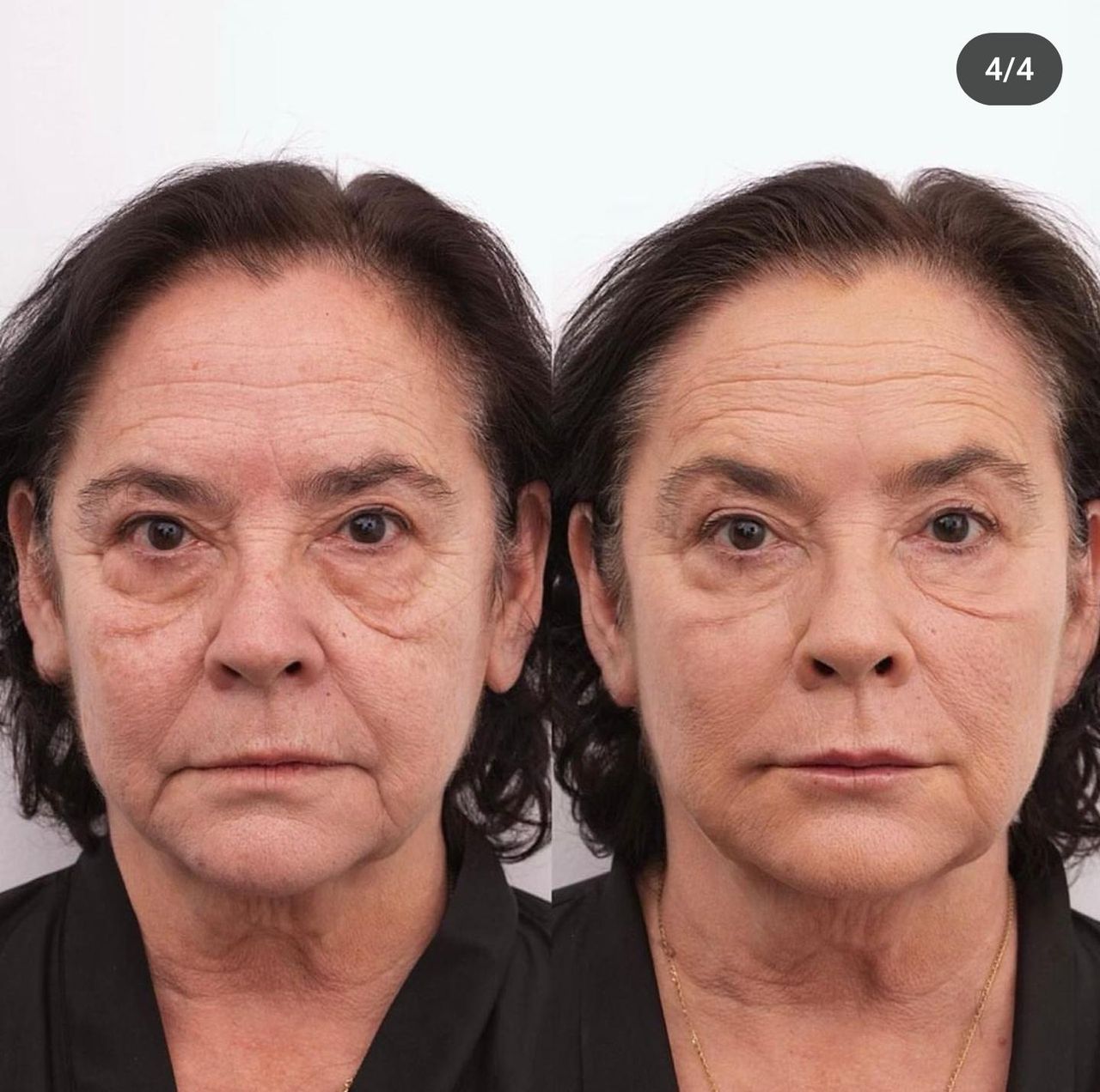 Raquel Moreno Pentinel-60