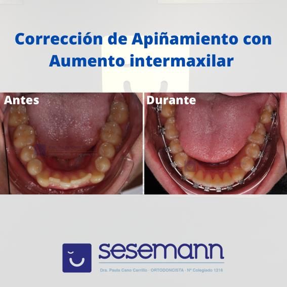 Paula Cano Carrillo-28