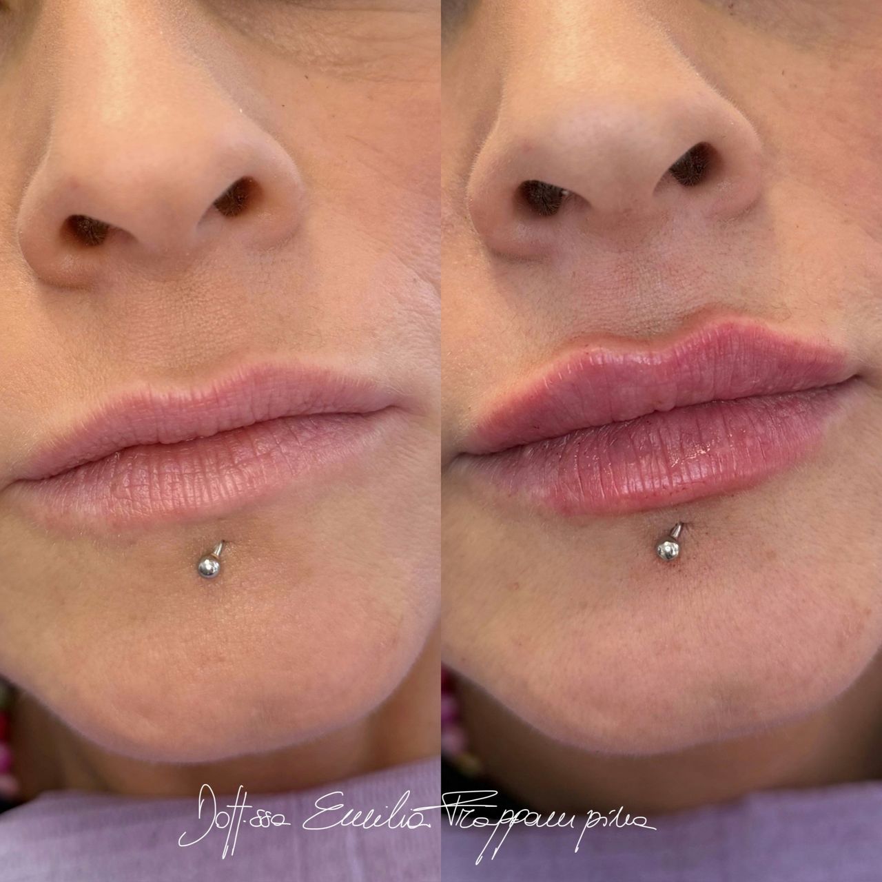 Emilia Frappampina-8