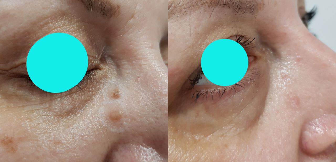 Rosalba Herrero Zerpa-218