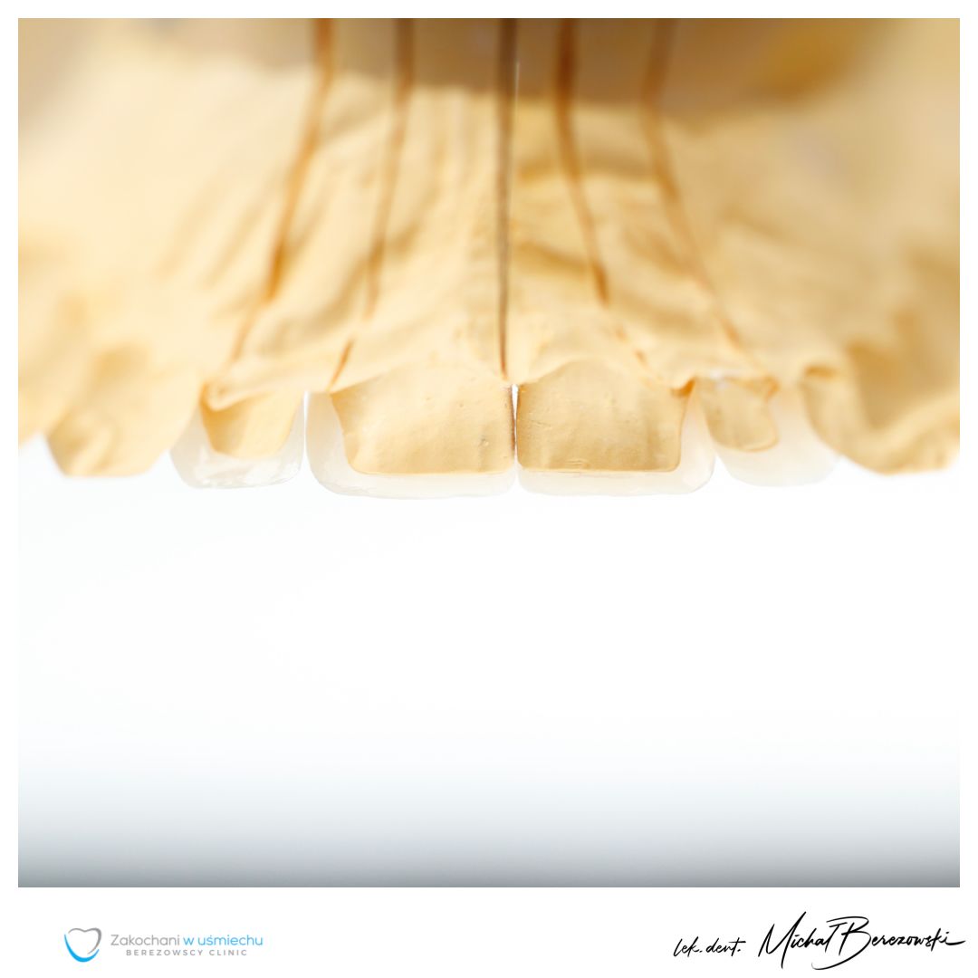 Michał Berezowski-8