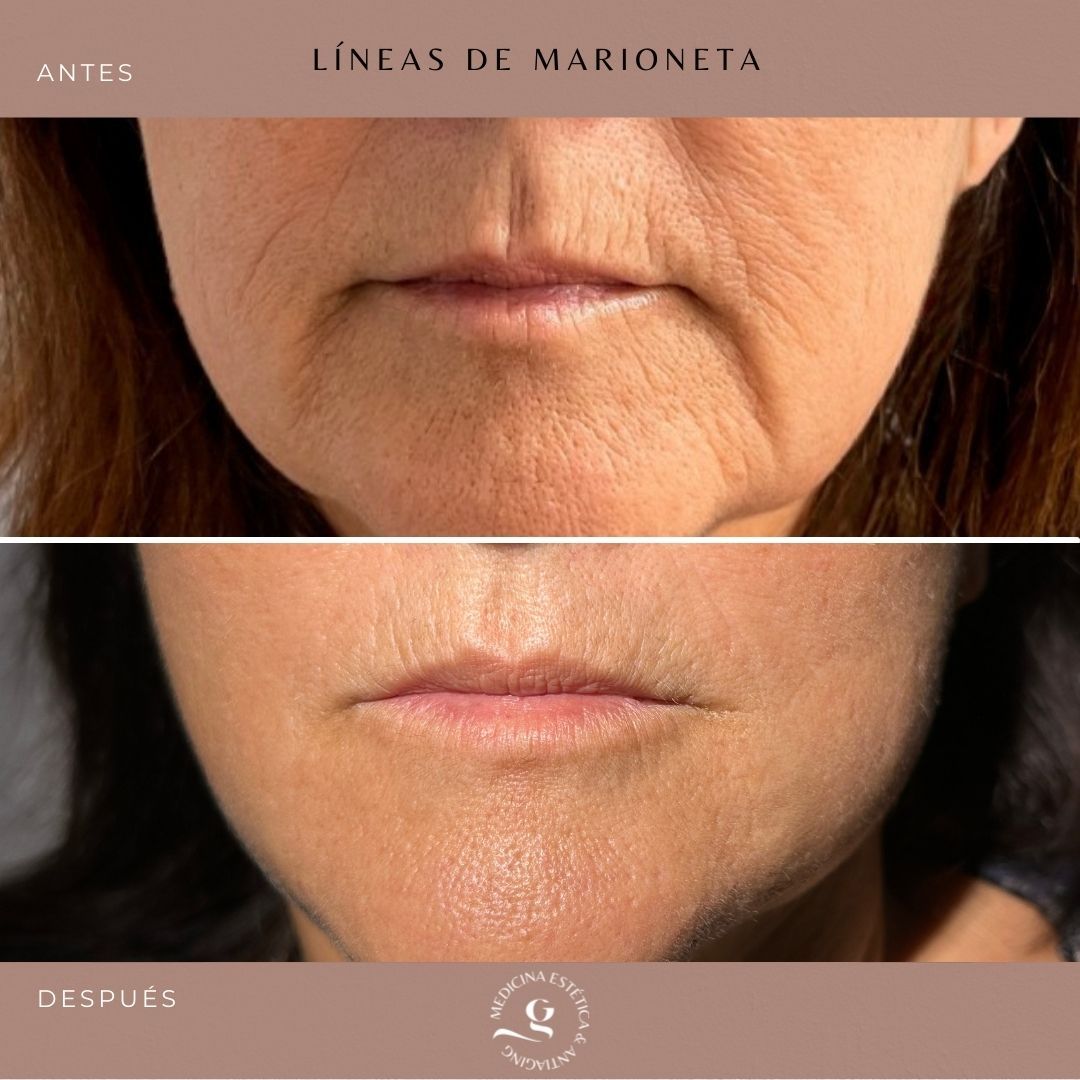 ​Giovanni Giorgianni-26