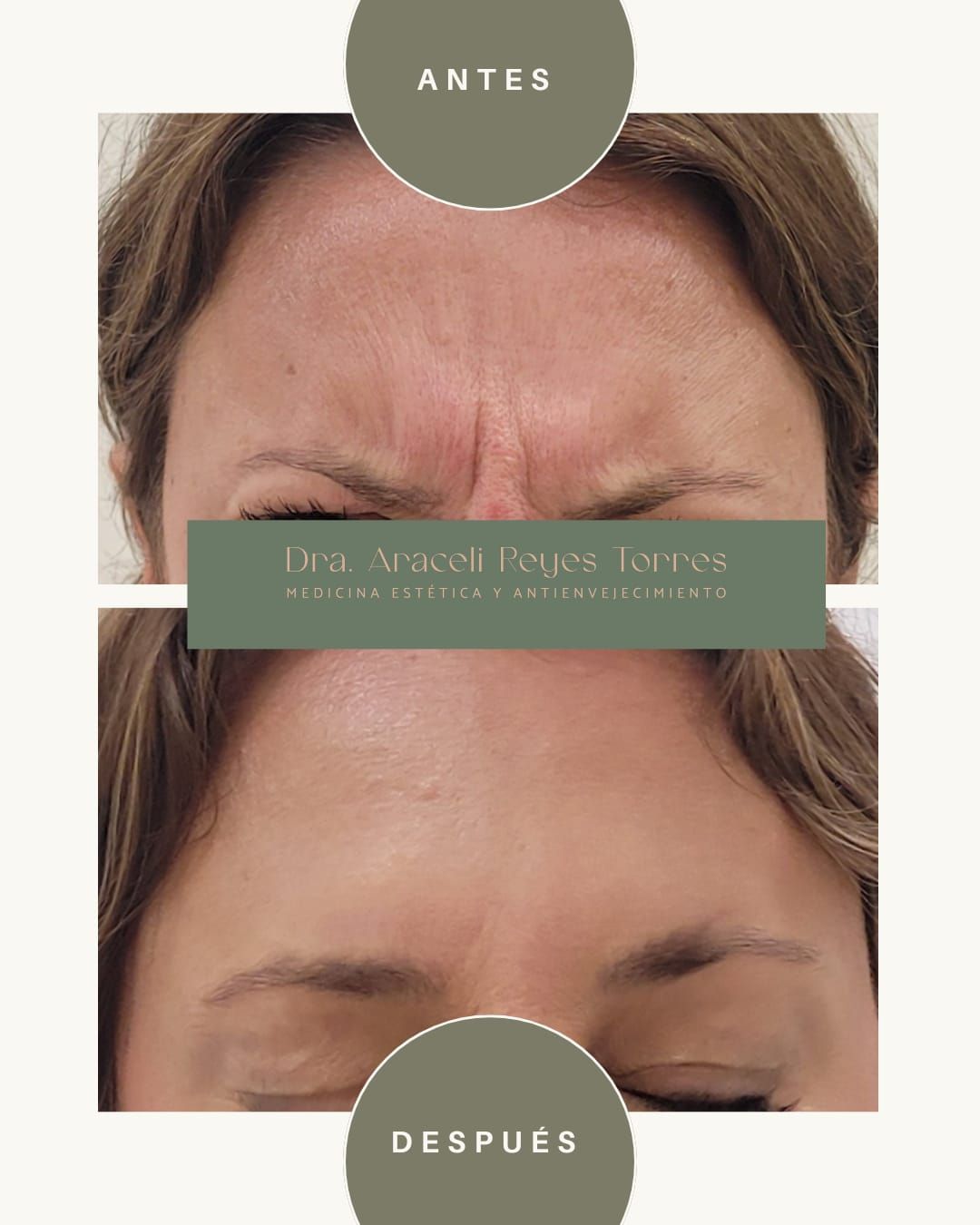 Araceli Reyes Torres-4