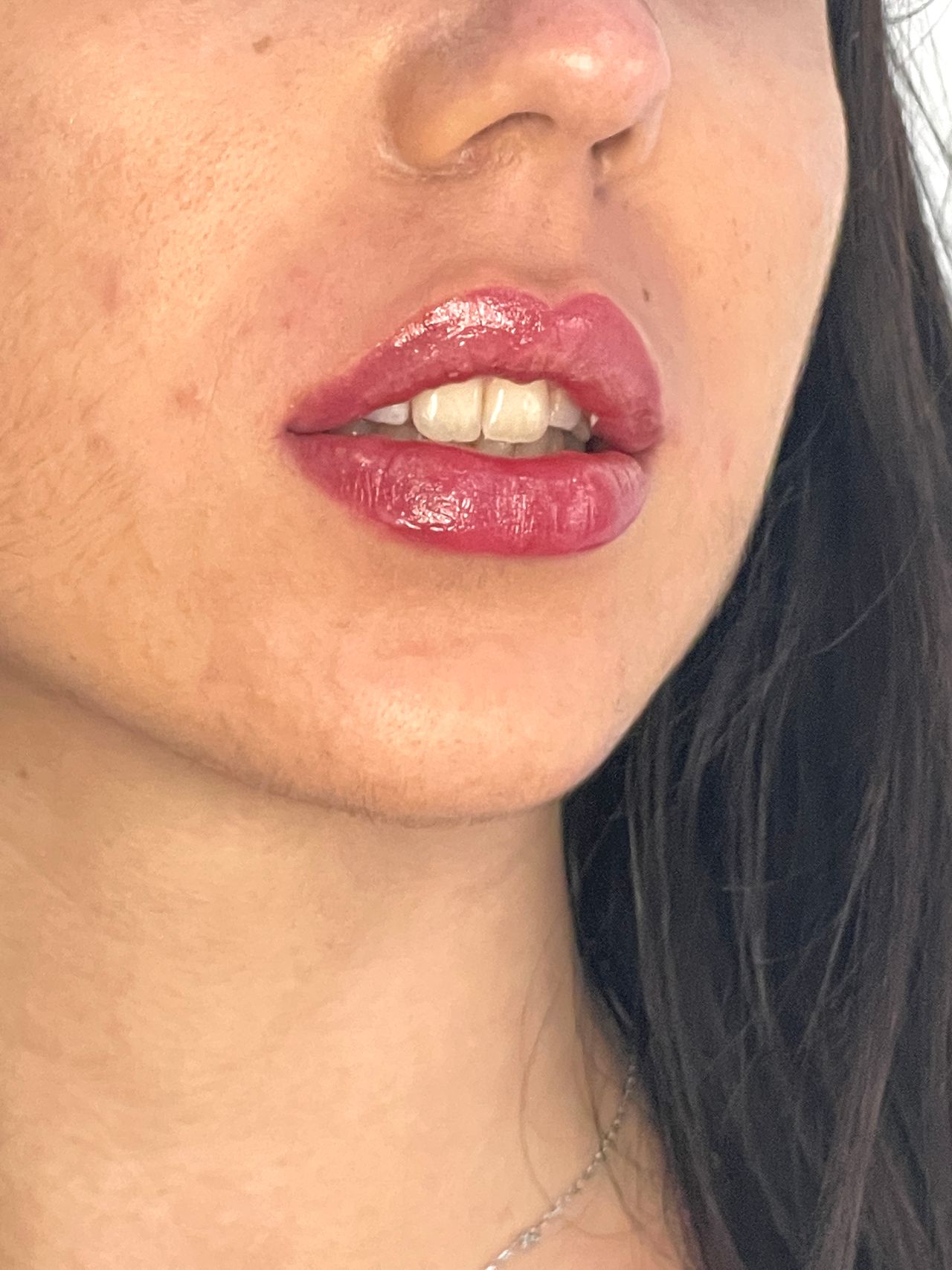 Alberto Alessandri-9