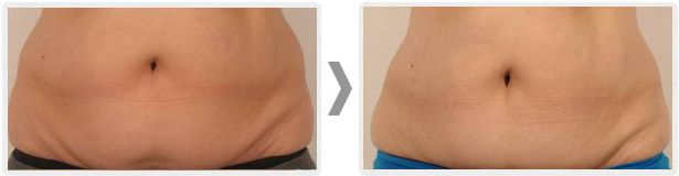 Anita Orzechowska-17