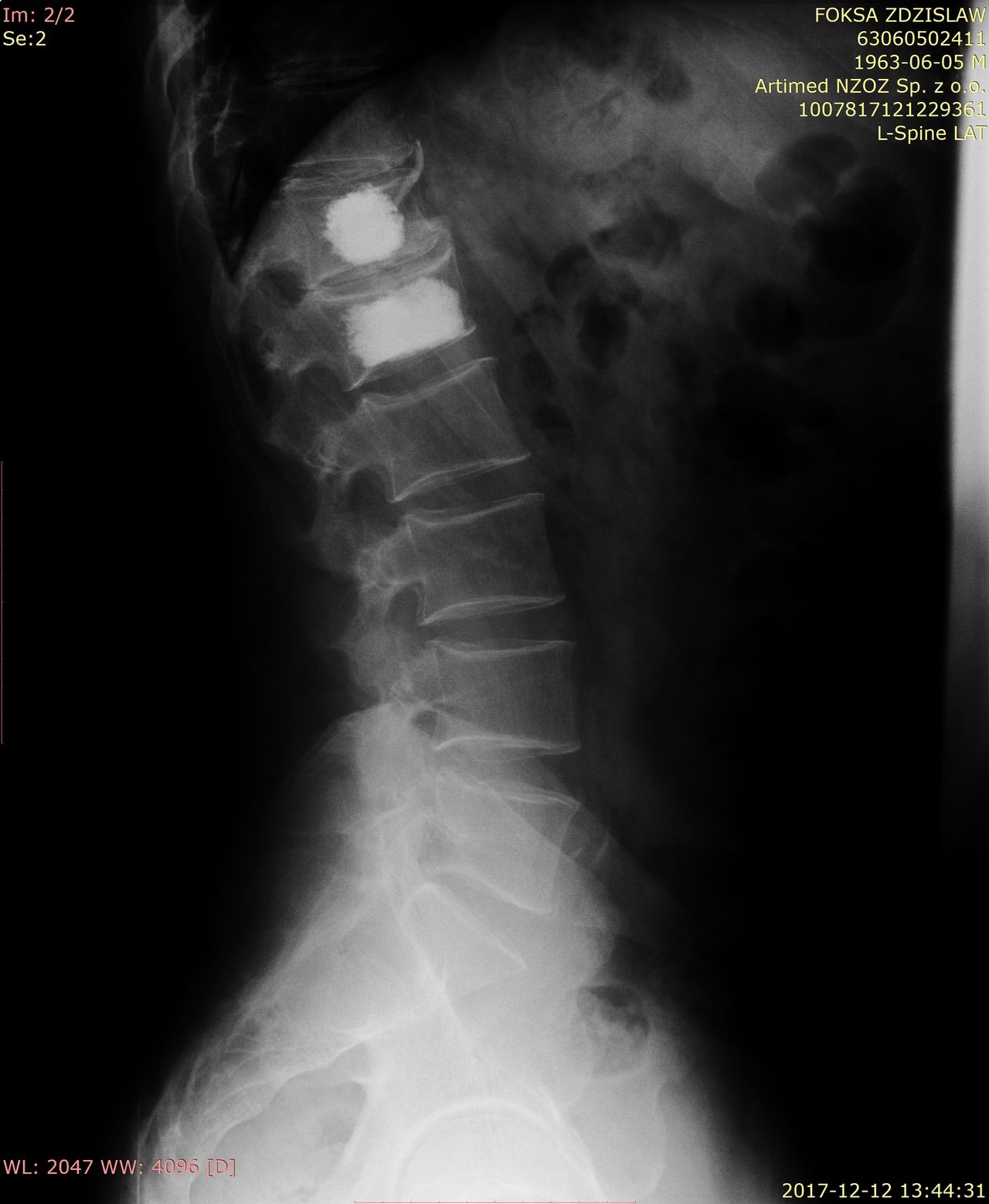 Jarosław Andrychowski-43