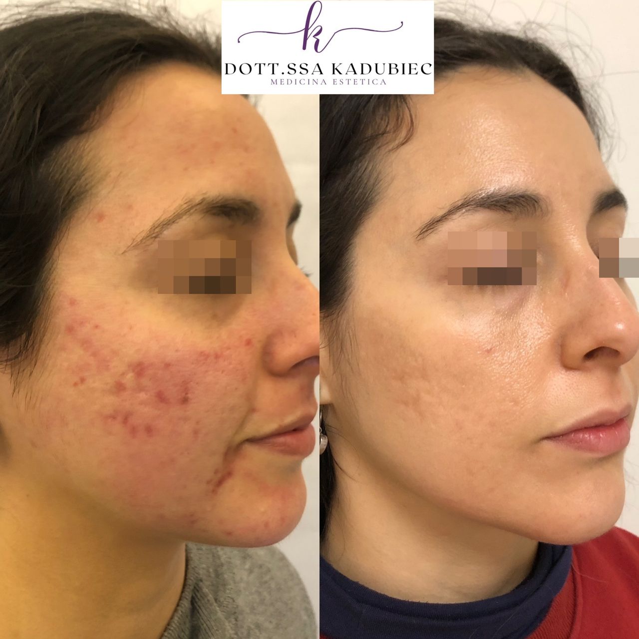 Aleksandra Kadubiec-17