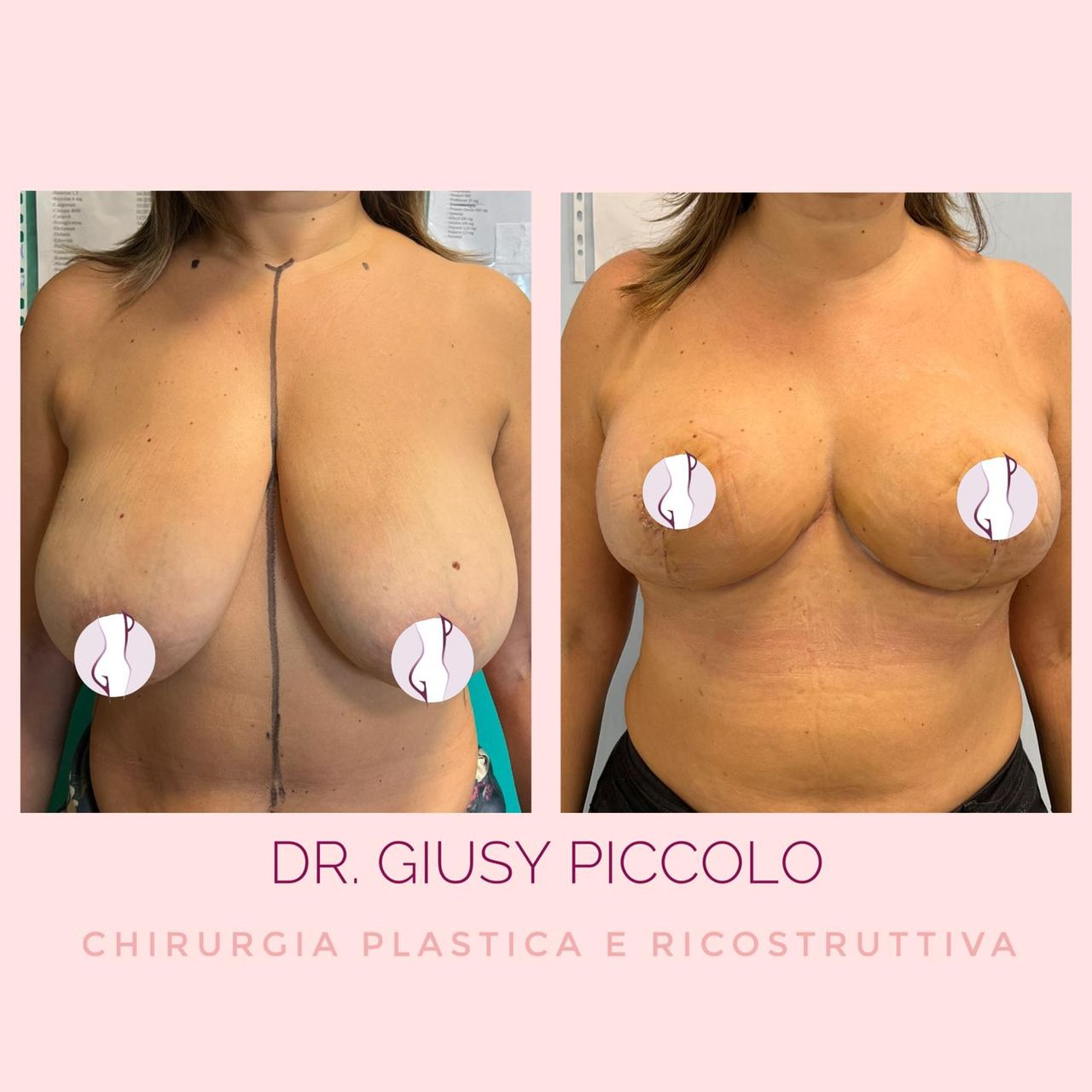 Giuseppina Piccolo-17