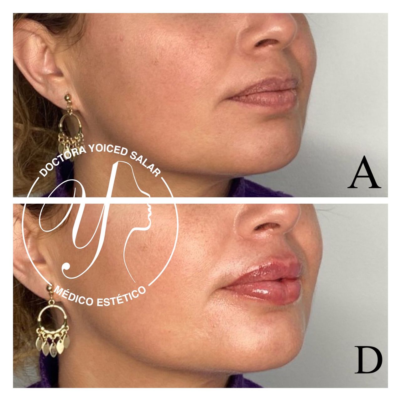 Yoiced Salar Peñate-6