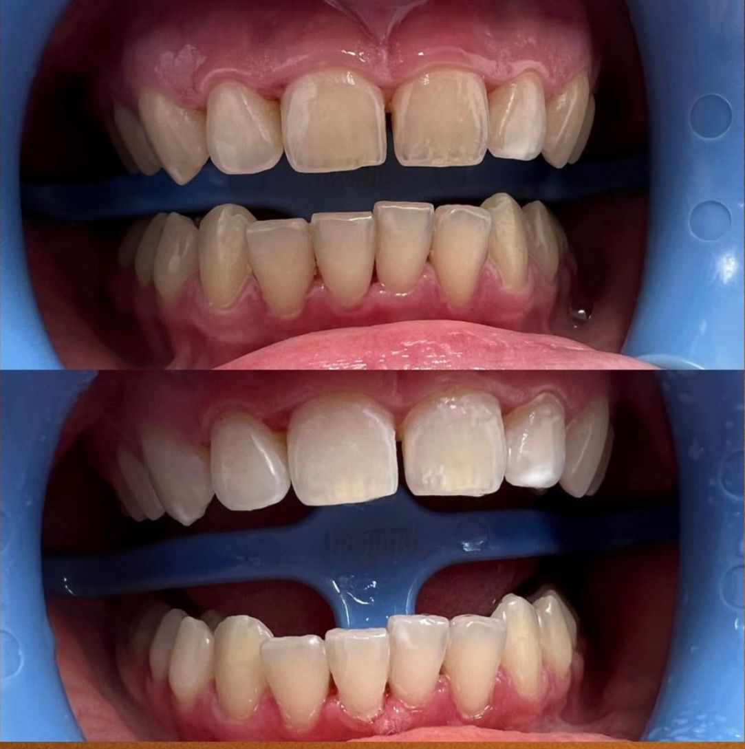 Oleksandra Chernykh-17