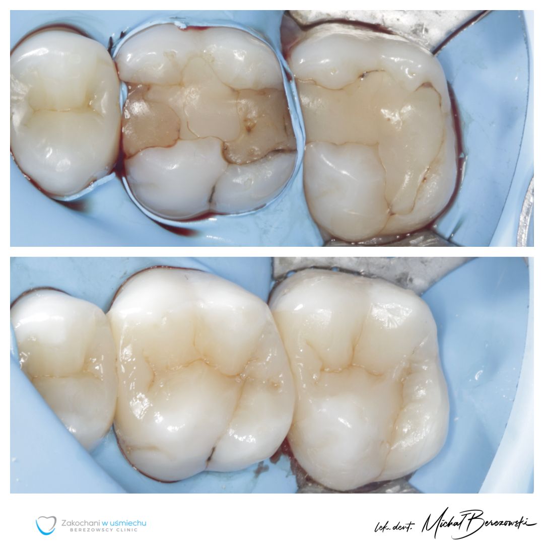 Michał Berezowski-20