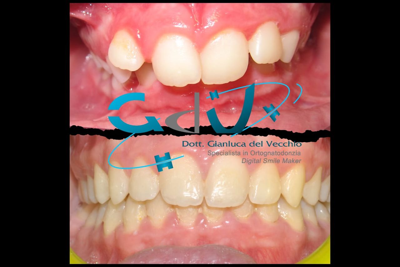 Gianluca Del Vecchio-157