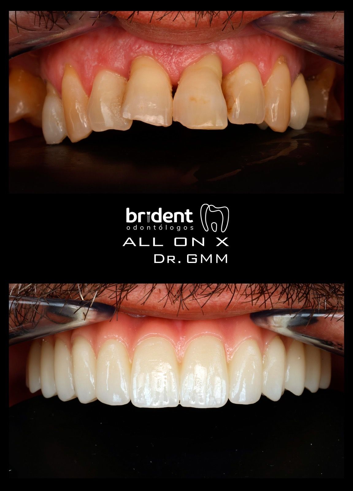 Guillermo Moreno Fragoso-68