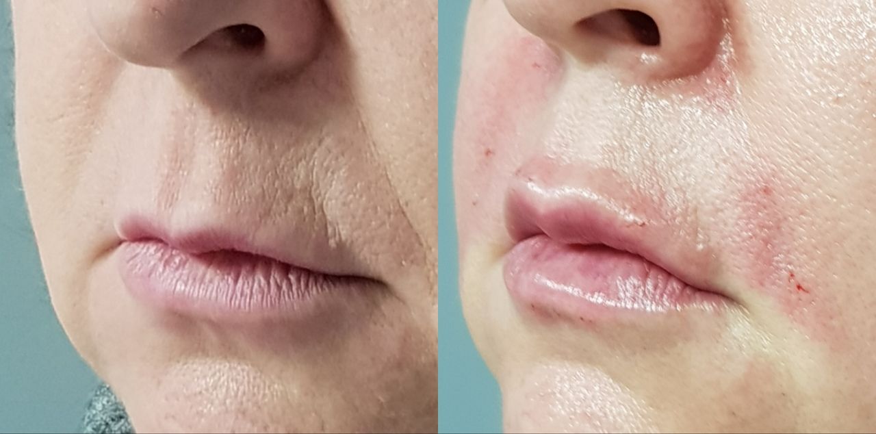 Rosalba Herrero Zerpa-116