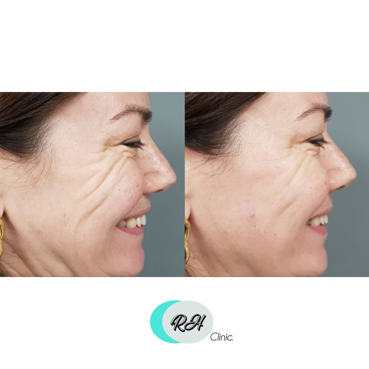 Rosalba Herrero Zerpa-89