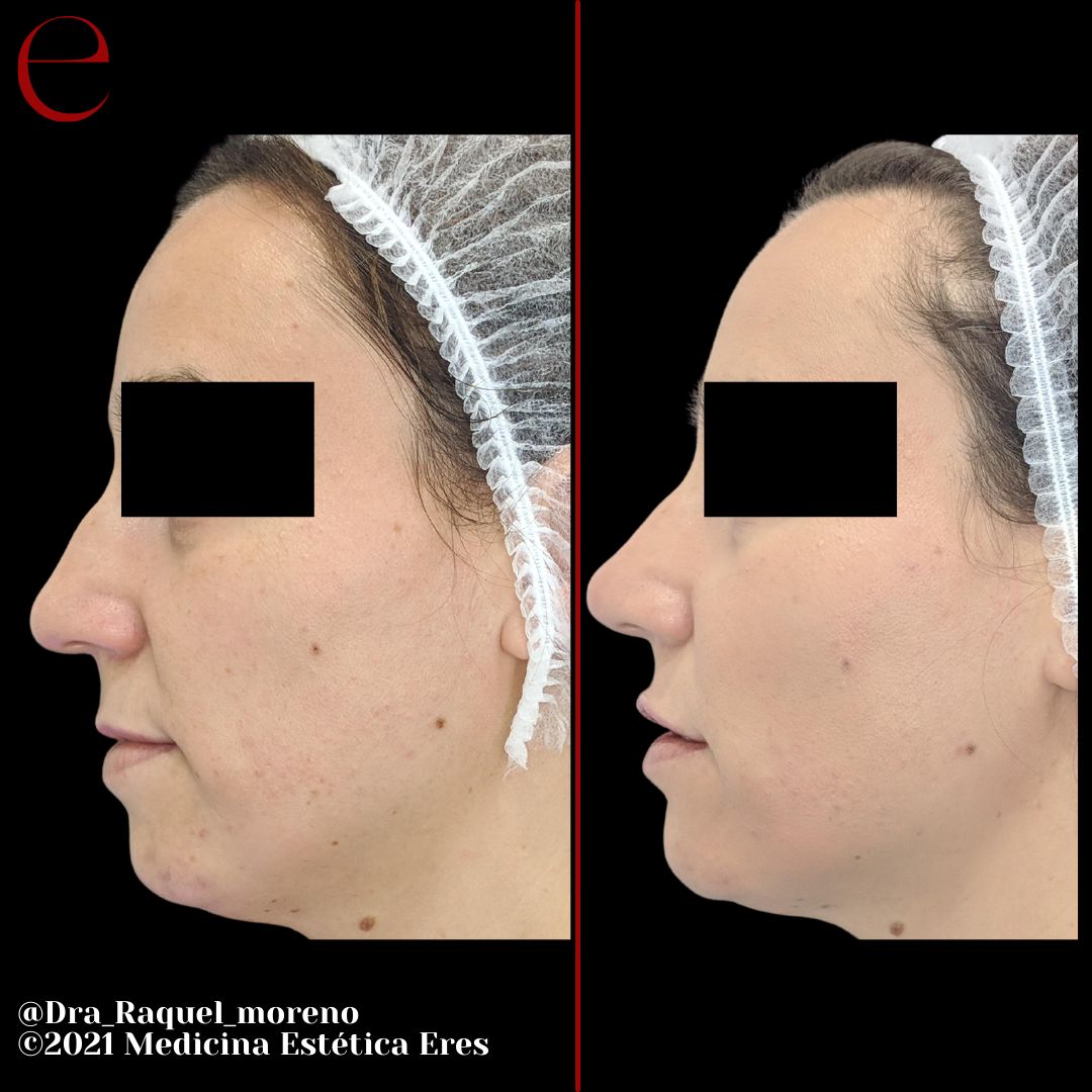 Raquel Moreno Pentinel-97