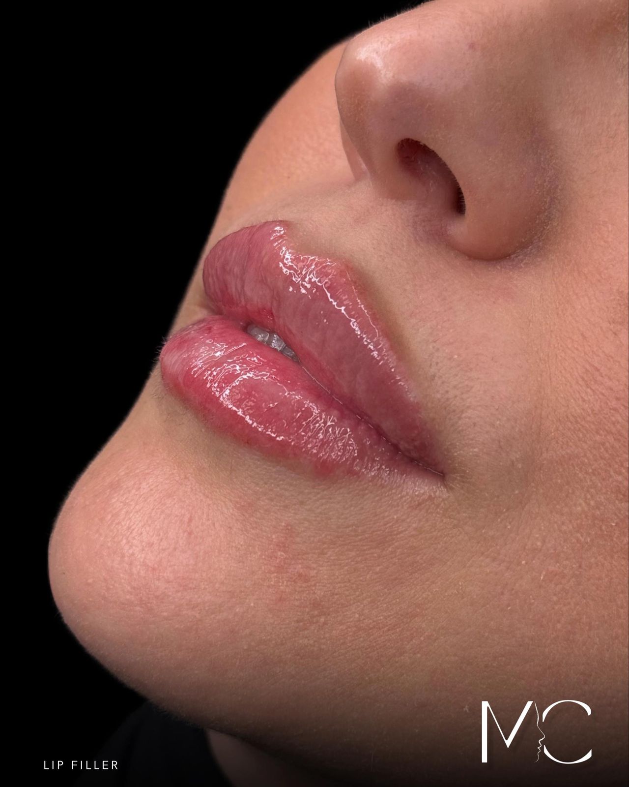 Maddalena Colecchia-3