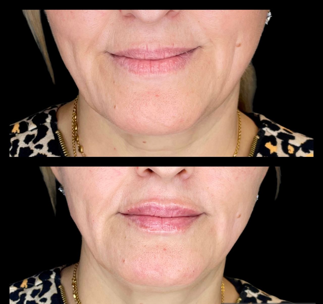 Alessandra Venezia-4