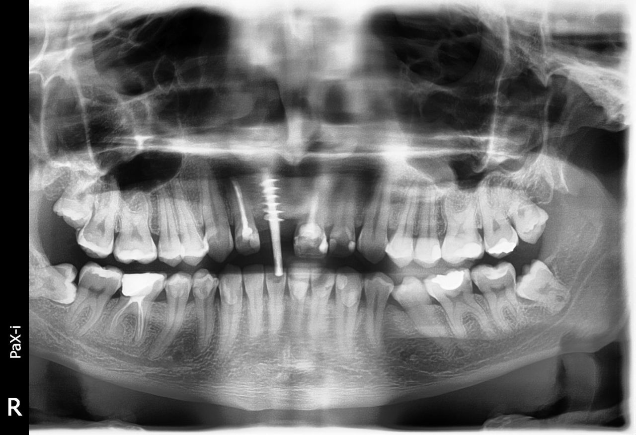 Krzysztof Zieliński-15