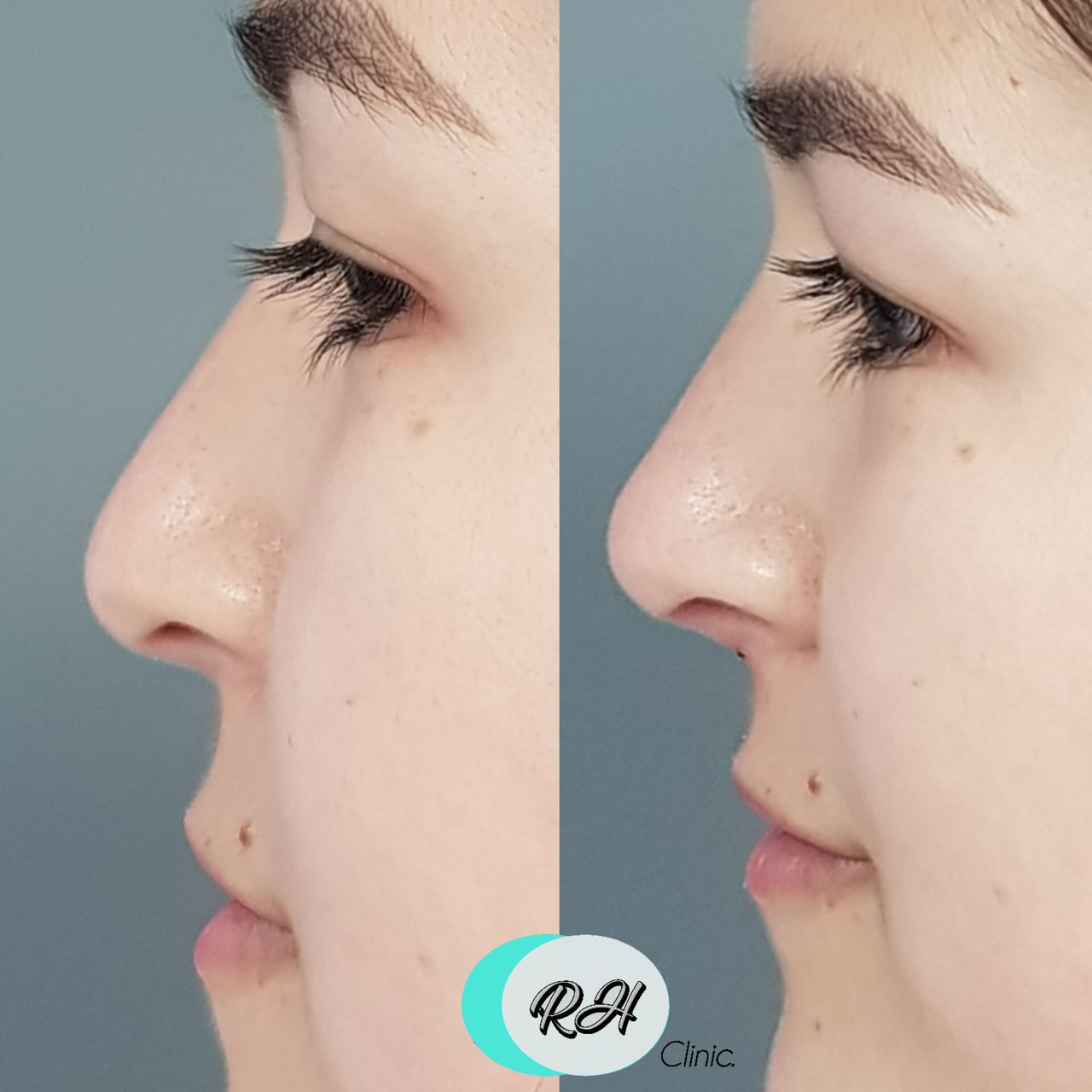 Rosalba Herrero Zerpa-591