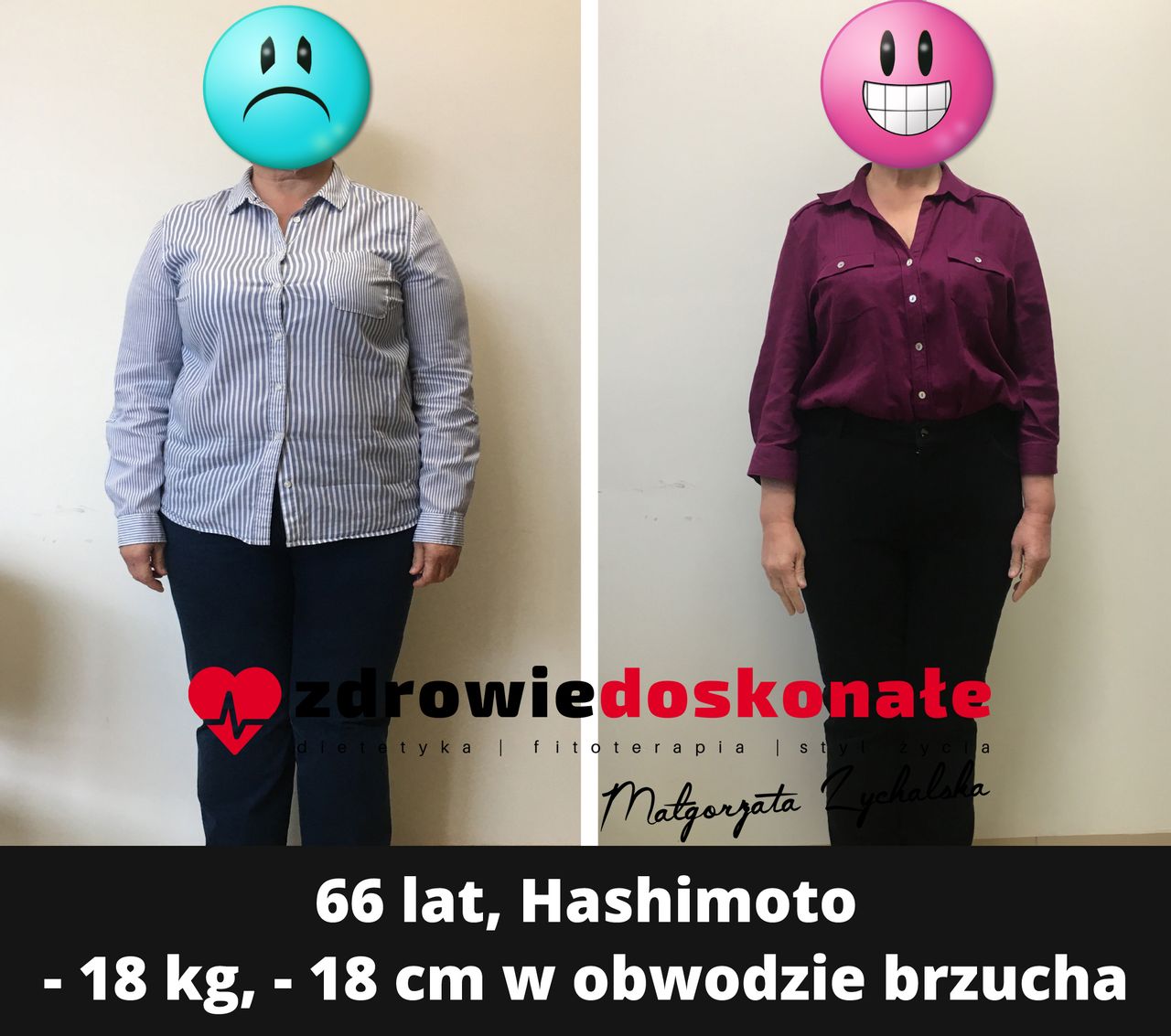 Małgorzata Zychalska-47