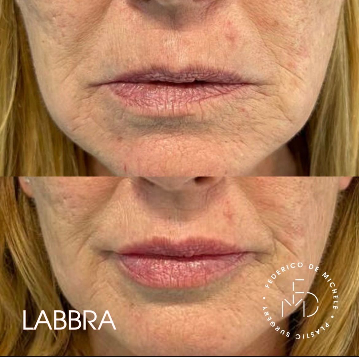 Federico De Michele-10