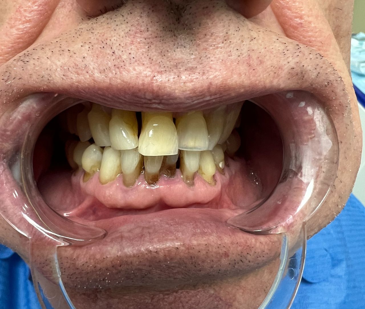 Luigi Aiardo Esposito-12