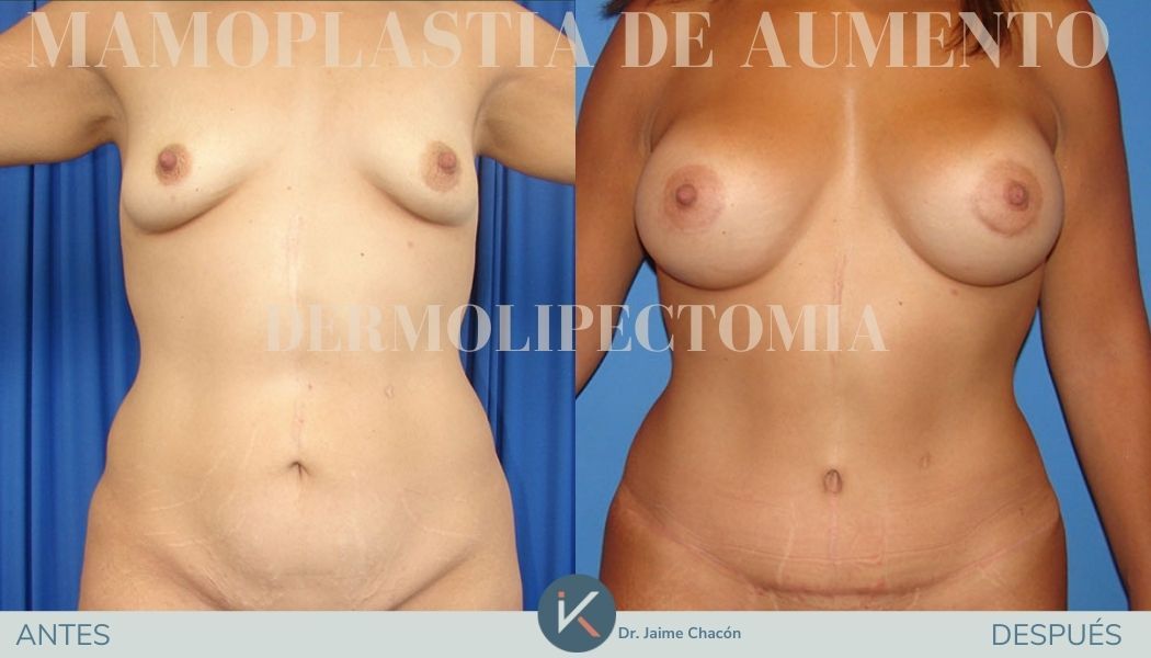 Jaime Eduardo Chacón Hernández-7