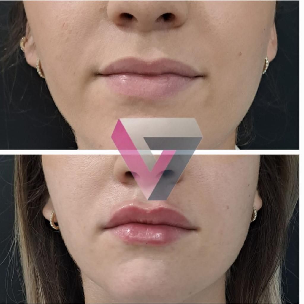 Victoria Trasmonte-47