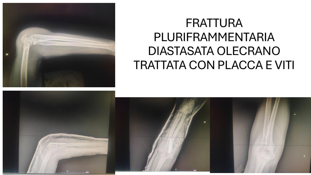 Bartolomeo D'amora-13