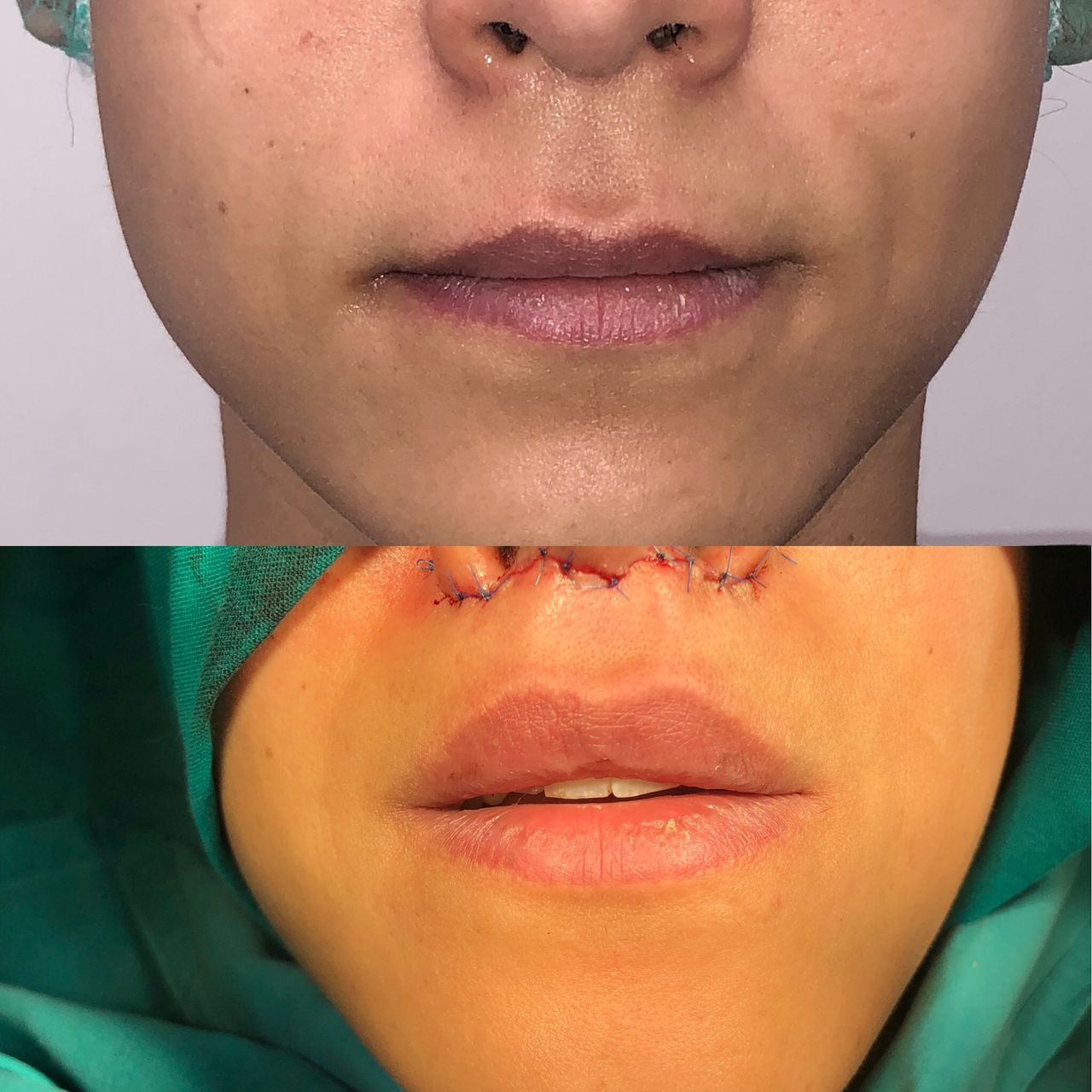 Alberto Candau Álvarez-26