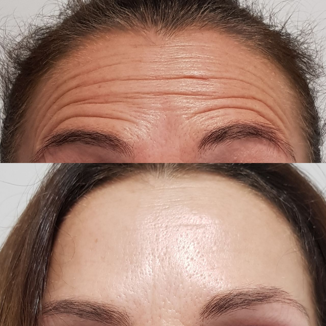 Rosalba Herrero Zerpa-304