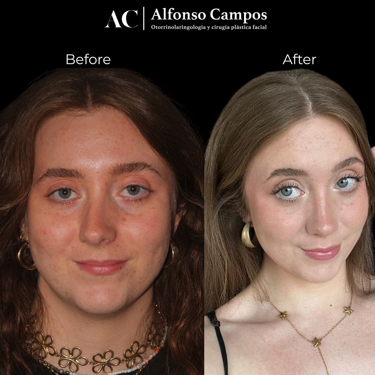 Alfonso Campos Gonzalez-5