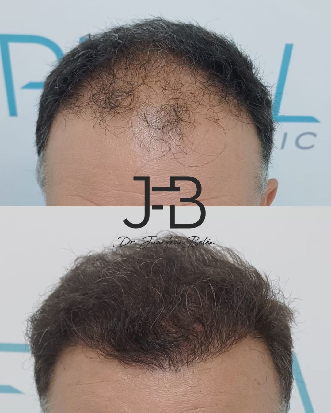 Juan Francisco Belén Montero-38