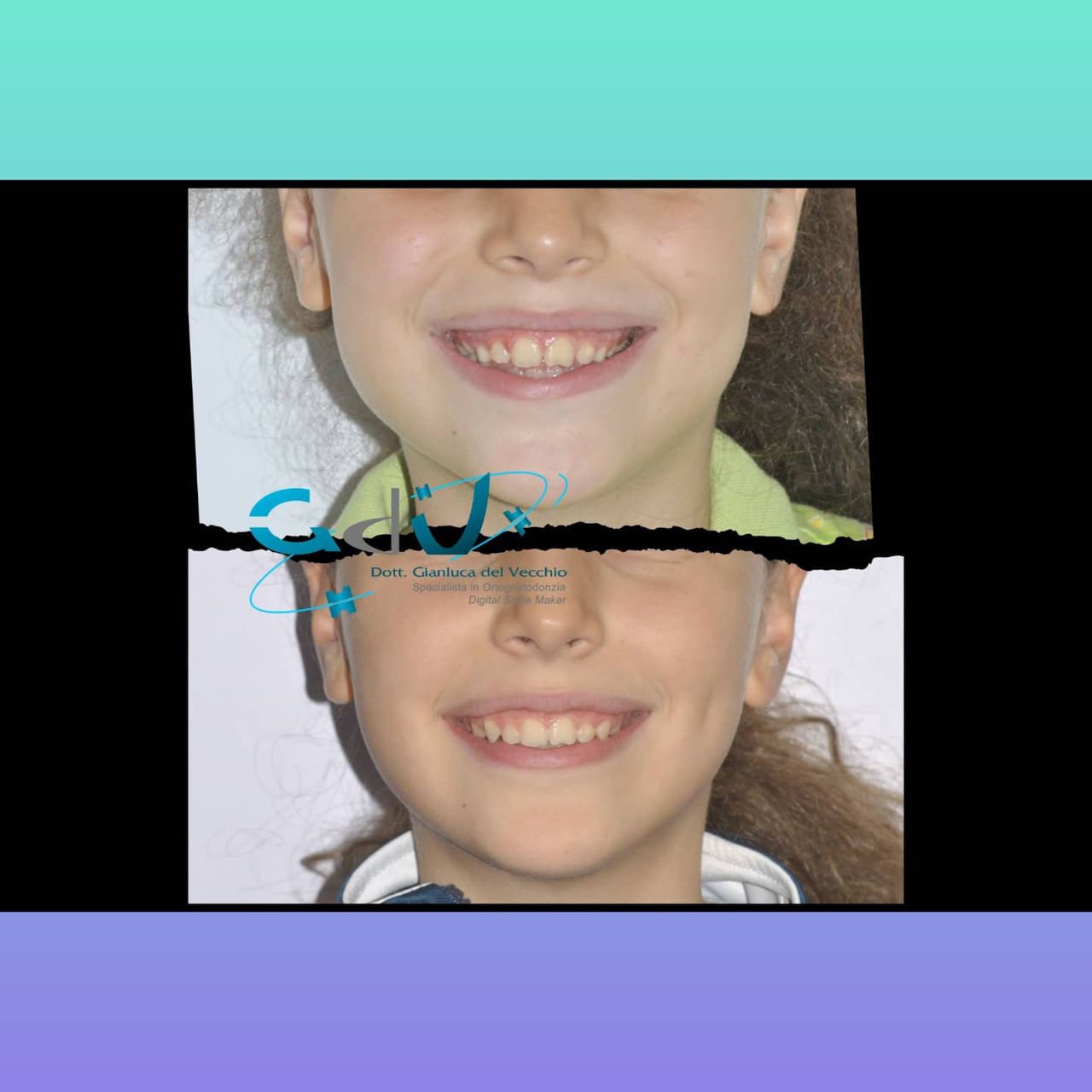 Gianluca Del Vecchio-158