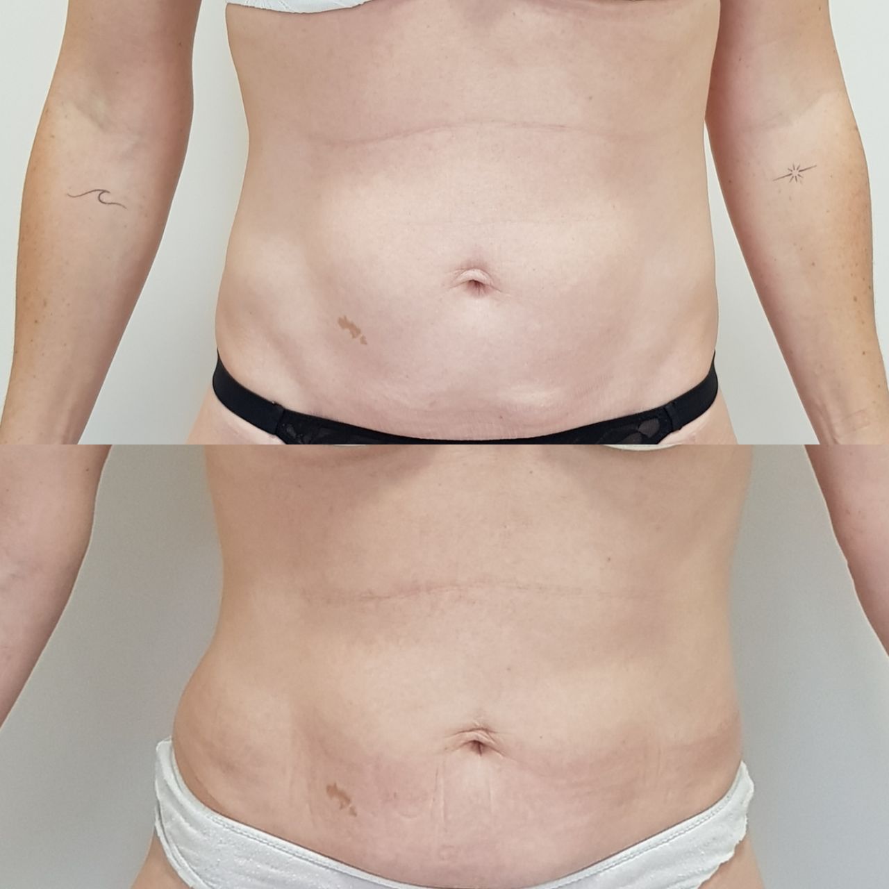 Rosalba Herrero Zerpa-291