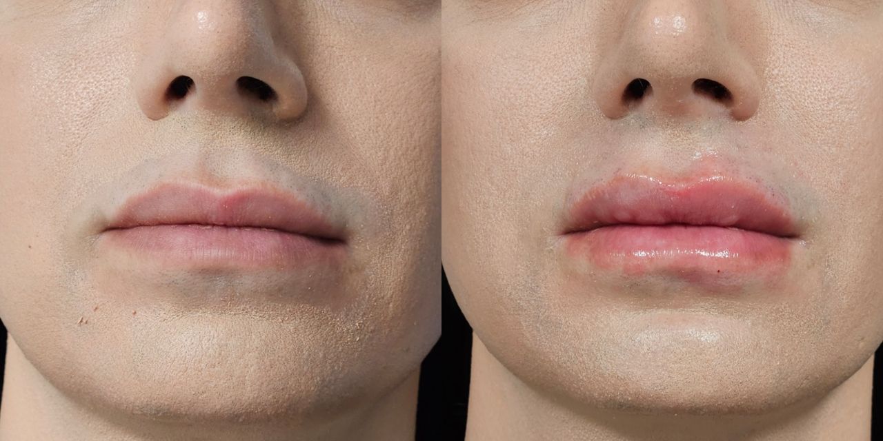 Rosalba Herrero Zerpa-454