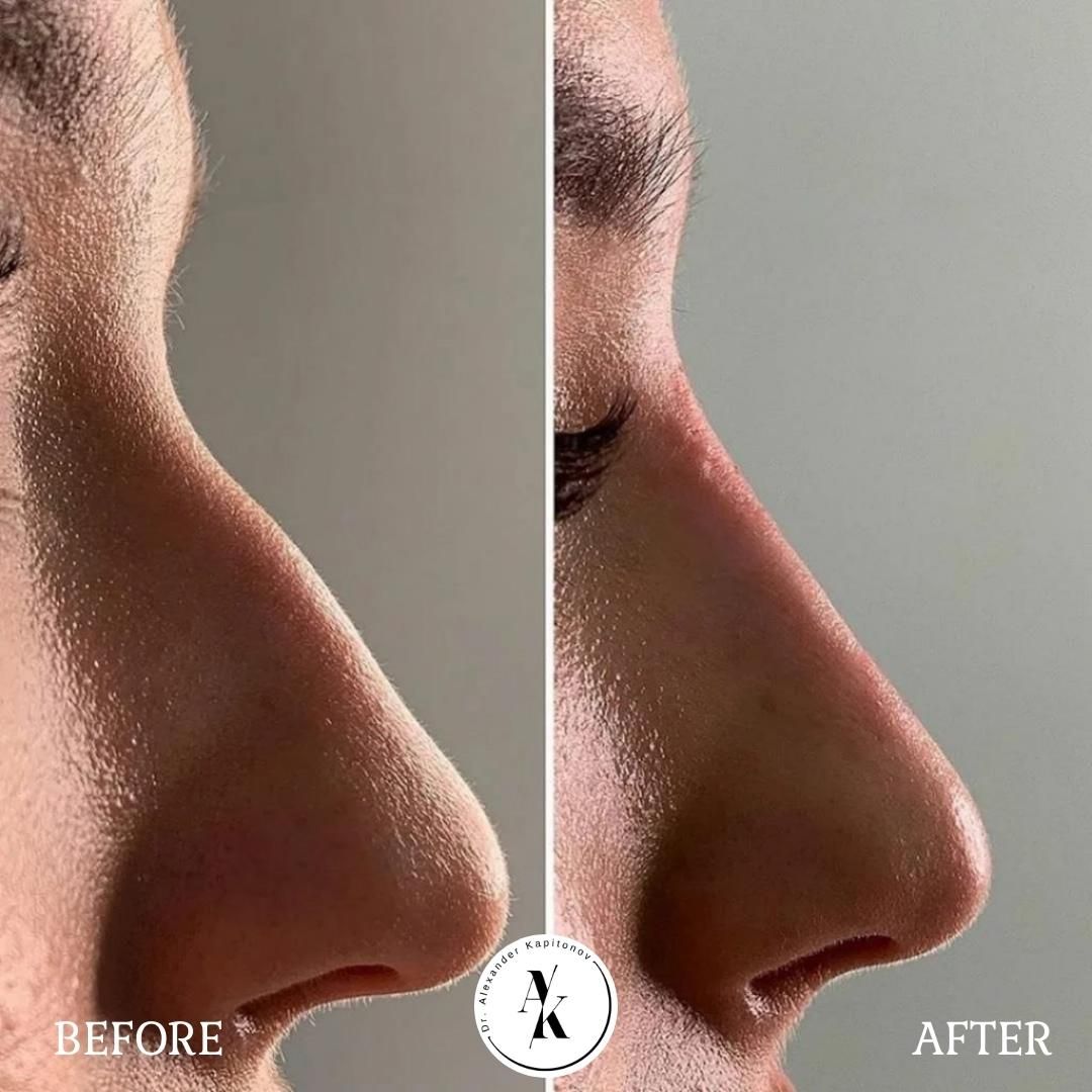 Alexandr Kapitonov-6