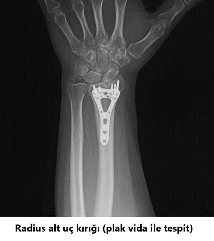 Javid M. Azarabadı-17