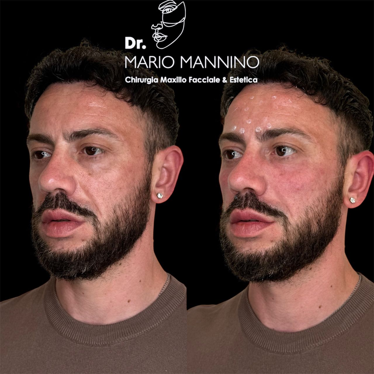 Mario Mannino-13