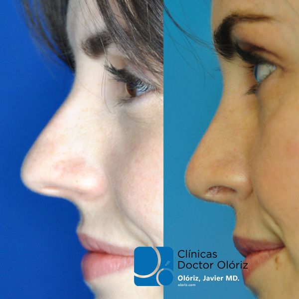 Javier Oloriz Marin-13