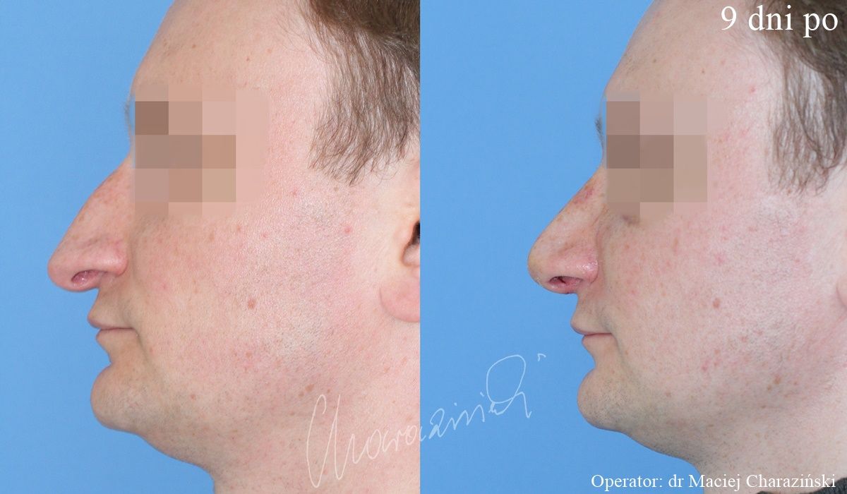 Maciej Charaziński-25