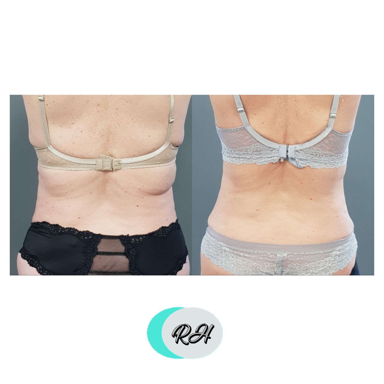 Rosalba Herrero Zerpa-187